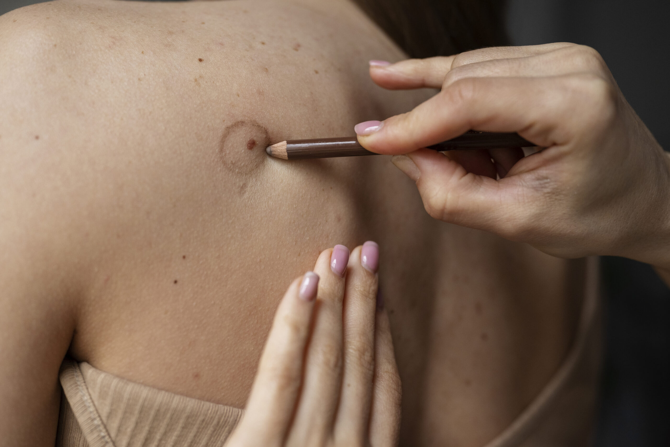 especialista dermatólogo revisando manchas solares en paciente